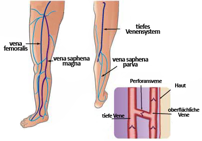 Das Venen-System der Beine